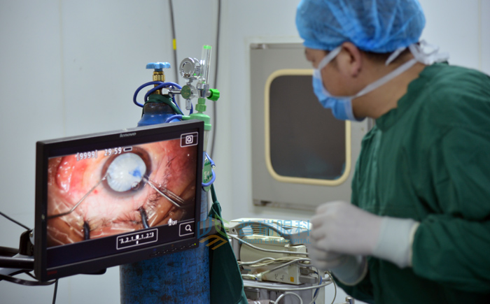 文字版，白內障手術過程要看看哦